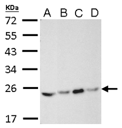 Anti-RAB5A antibody used in Western Blot (WB). GTX109665