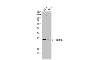 Anti-RAB5A antibody used in Western Blot (WB). GTX109665