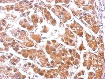 Anti-PUMA antibody [C2C3], C-term used in IHC (Paraffin sections) (IHC-P). GTX109675