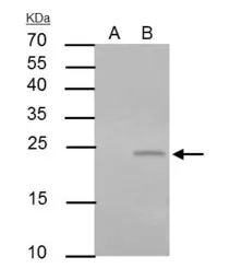 Anti-PUMA antibody [C2C3], C-term used in Immunoprecipitation (IP). GTX109675