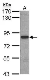 Anti-3BP2 antibody used in Western Blot (WB). GTX109708