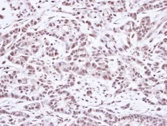 Anti-SMC1A antibody [N1N2], N-term used in IHC (Paraffin sections) (IHC-P). GTX109724