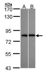 Anti-DDX3 antibody used in Western Blot (WB). GTX109727