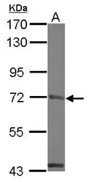 Anti-MCM4 antibody used in Western Blot (WB). GTX109740
