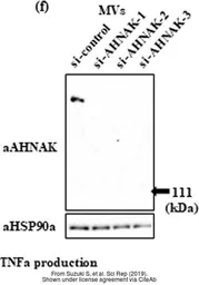 Anti-Hsp90 alpha antibody used in Western Blot (WB). GTX109753