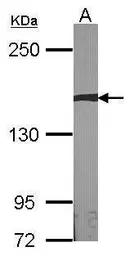 Anti-AUTS2 antibody [N3C1], Internal used in Western Blot (WB). GTX109811