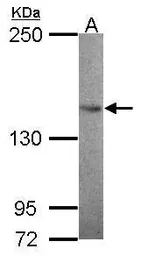 Anti-SMC3 antibody [N1N2], N-term used in Western Blot (WB). GTX109827