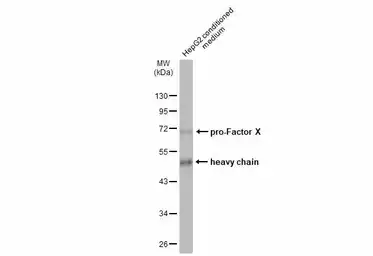 Anti-Factor X antibody used in Western Blot (WB). GTX109830