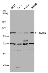 Anti-MARS antibody [N3C2], Internal used in Western Blot (WB). GTX109864