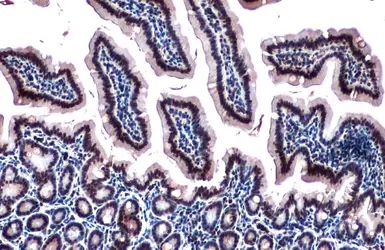 Anti-RBM15 antibody [N1N3] used in IHC (Paraffin sections) (IHC-P). GTX109899