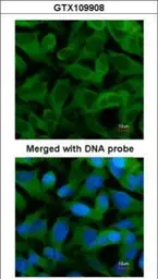 Anti-TCP1 epsilon antibody [N1N3] used in Immunocytochemistry/ Immunofluorescence (ICC/IF). GTX109908