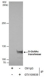 Anti-O-GlcNAc transferase antibody used in Immunoprecipitation (IP). GTX109939