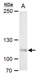 Anti-O-GlcNAc transferase antibody used in Western Blot (WB). GTX109939