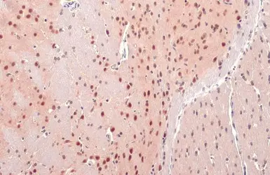 Anti-O-GlcNAc transferase antibody used in IHC (Paraffin sections) (IHC-P). GTX109939