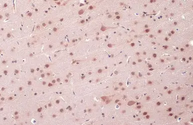 Anti-O-GlcNAc transferase antibody used in IHC (Paraffin sections) (IHC-P). GTX109939