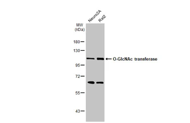 Anti-O-GlcNAc transferase antibody used in Western Blot (WB). GTX109939