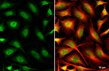Anti-O-GlcNAc transferase antibody used in Immunocytochemistry/ Immunofluorescence (ICC/IF). GTX109939