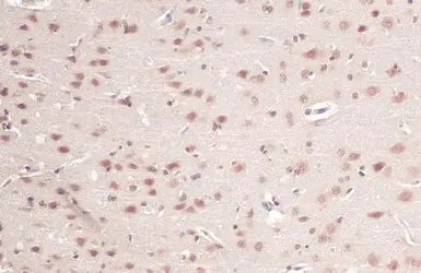 Anti-O-GlcNAc transferase antibody used in IHC (Paraffin sections) (IHC-P). GTX109939