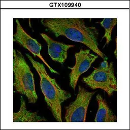 Anti-Villin antibody used in Immunocytochemistry/ Immunofluorescence (ICC/IF). GTX109940