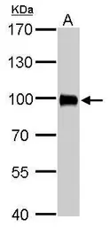 Anti-Villin antibody used in Western Blot (WB). GTX109940