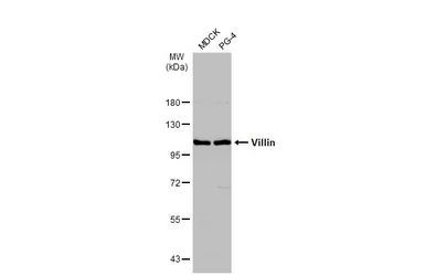 Anti-Villin antibody used in Western Blot (WB). GTX109940