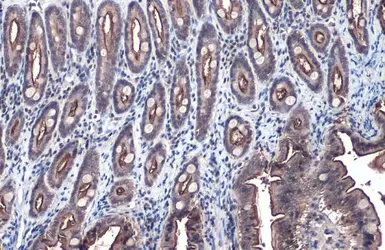 Anti-Villin antibody used in IHC (Paraffin sections) (IHC-P). GTX109940