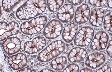 Anti-Villin antibody used in IHC (Paraffin sections) (IHC-P). GTX109940