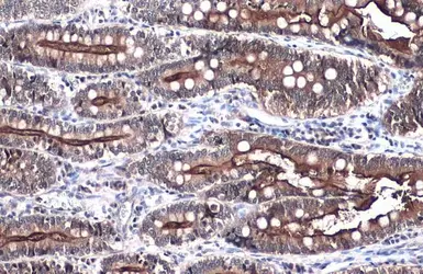 Anti-Villin antibody used in IHC (Paraffin sections) (IHC-P). GTX109940