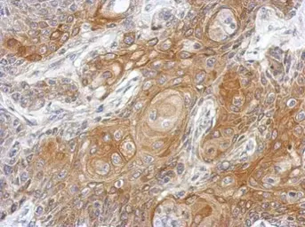 Anti-Vitamin D Binding Protein antibody used in IHC (Paraffin sections) (IHC-P). GTX109955
