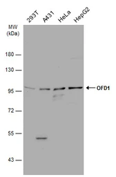 Anti-OFD1 antibody used in Western Blot (WB). GTX110010
