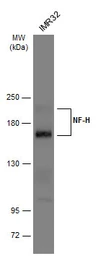 Anti-NF-H antibody used in Western Blot (WB). GTX110065