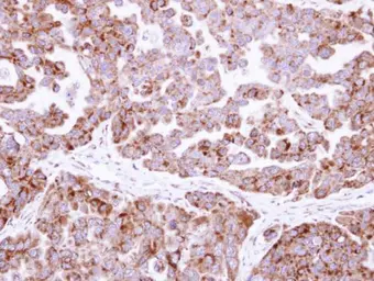 Anti-Fumarate hydratase antibody [N2C2], Internal used in IHC (Paraffin sections) (IHC-P). GTX110128