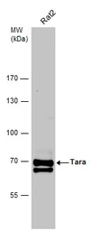 Anti-Tara antibody [C2C3-2], C-term used in Western Blot (WB). GTX110158