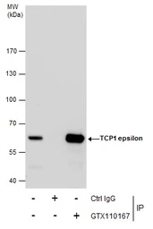 Anti-TCP1 epsilon antibody [N1C1] used in Immunoprecipitation (IP). GTX110167
