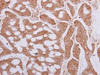 Anti-TCP1 epsilon antibody [N1C1] used in IHC (Paraffin sections) (IHC-P). GTX110167