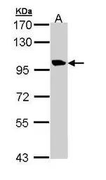 Anti-meckelin isoform 1 antibody [N2C1], Internal used in Western Blot (WB). GTX110171