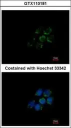 Anti-ALDH5A1 antibody [N1C1] used in Immunocytochemistry/ Immunofluorescence (ICC/IF). GTX110181