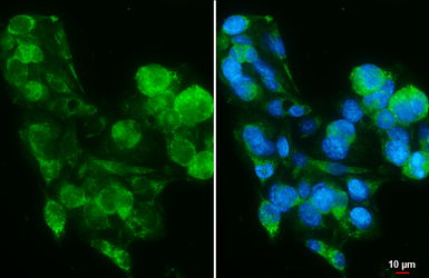 Anti-PIGR antibody [N2C1], Internal used in Immunocytochemistry/ Immunofluorescence (ICC/IF). GTX110197