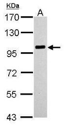 PLA2G4A抗体 (GTX110218)