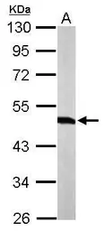 Anti-Tryptophanyl tRNA synthetase antibody used in Western Blot (WB). GTX110223