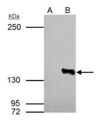 Anti-HDAC4 antibody [N3C1], Internal used in Immunoprecipitation (IP). GTX110231