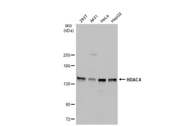 Anti-HDAC4 antibody [N3C1], Internal used in Western Blot (WB). GTX110231