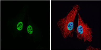 Anti-MCM3 antibody used in Immunocytochemistry/ Immunofluorescence (ICC/IF). GTX110241