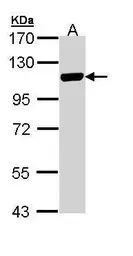 Anti-MCM3 antibody used in Western Blot (WB). GTX110241