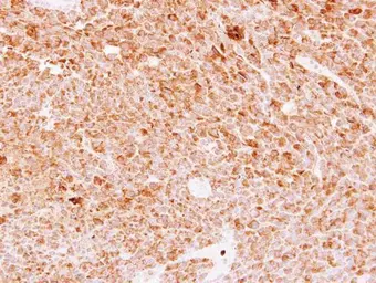 Anti-DMP4 antibody used in IHC (Paraffin sections) (IHC-P). GTX110258