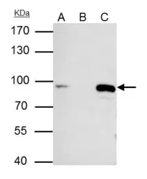 Anti-MCM7 antibody [N2C2], Internal used in Immunoprecipitation (IP). GTX110278