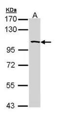 Anti-SAP102 antibody [C1C3] used in Western Blot (WB). GTX110289