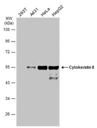 Anti-Cytokeratin 8 antibody used in Western Blot (WB). GTX110311
