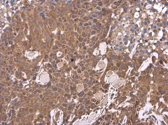 Anti-Hepatic lipase antibody [N1C1] used in IHC (Paraffin sections) (IHC-P). GTX110336