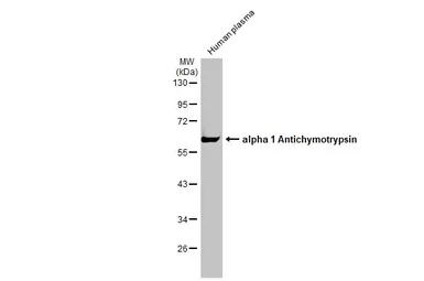 Anti-alpha 1 Antichymotrypsin antibody used in Western Blot (WB). GTX110359